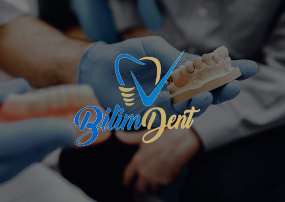 Protetik Diş Tedavisi